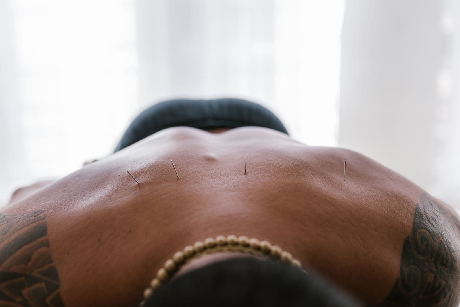 Holistic wellness comparison of chiropractic care and acupuncture approaches