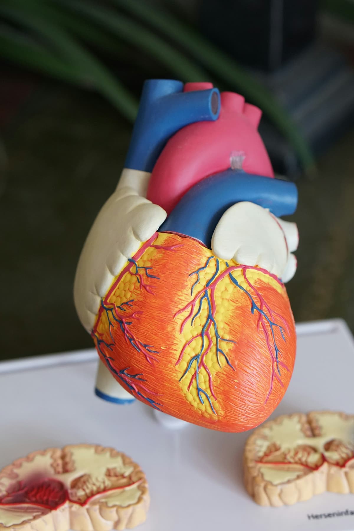 Anatomical heart image for cardiovascular health article