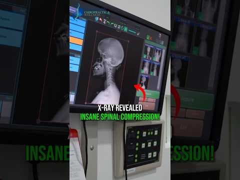 The X-Ray Revealed What Was Really Going On 👀