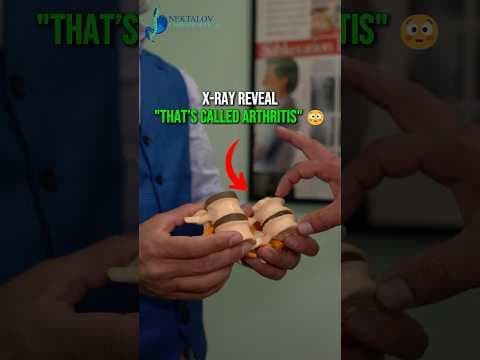 The Relief After This Adjustment Says It All 🙌🔥👀#chiropractic #painrelief #arthritis  #xray