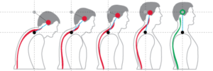 chiropractic bio physics