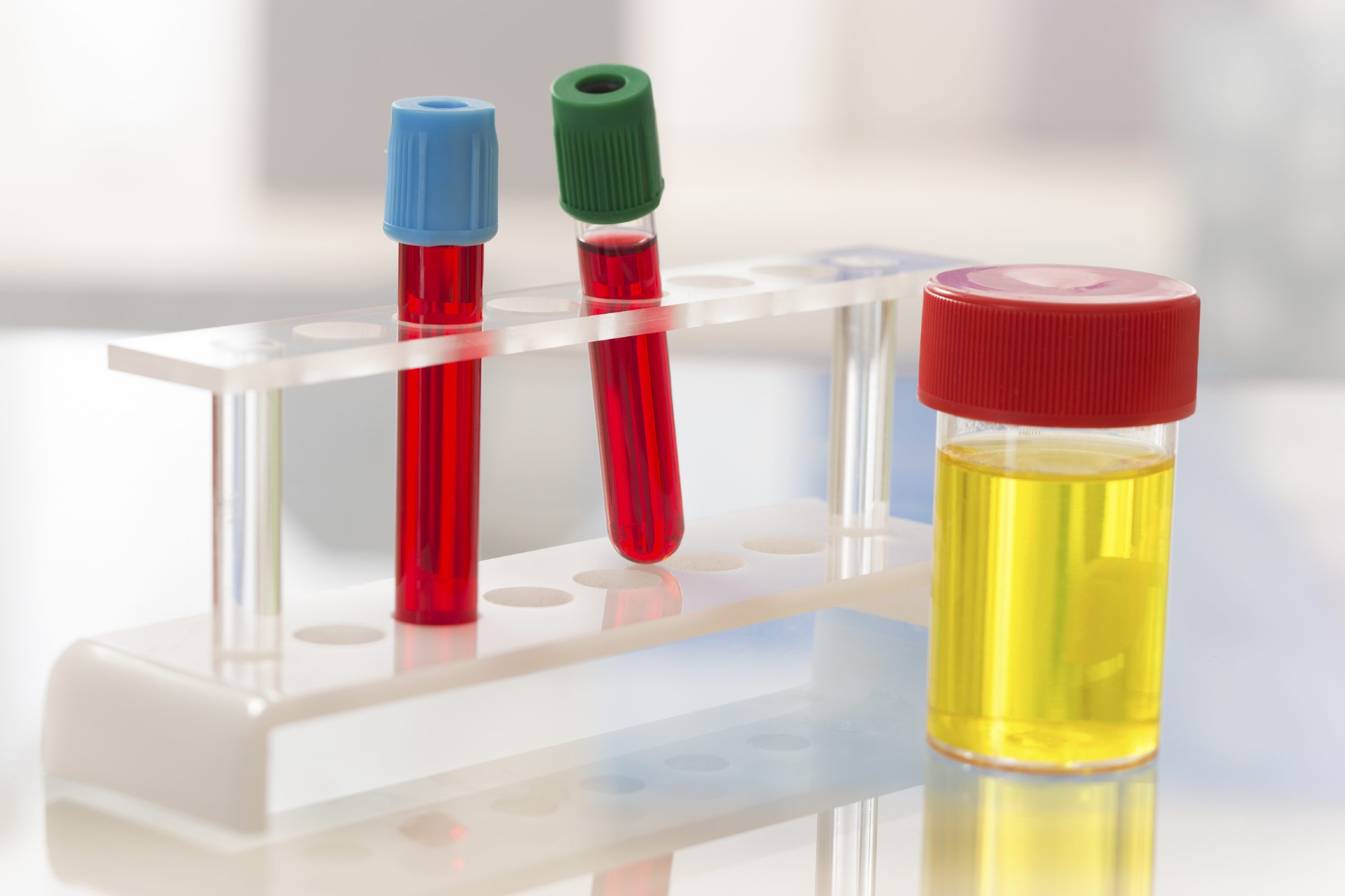 Medical: Sterile Urine sample and blood test